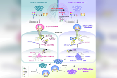 Breakthrough Research on Lung Cancer Pathway at National Cheng Kung University Gains Global Recognition